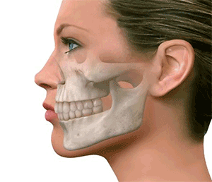 Prognatismo-mandibular-cirugia-ortognatica-cordoba