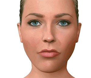 cirugia-ortognatica-asimetria-cordoba-dr-candau