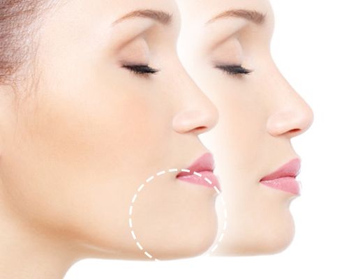 cirugía-ortognática-cordoba-dr-alberto-candau