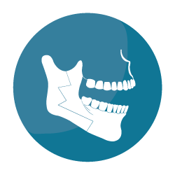 icono-cirugia-ortognatica-cordoba-dr-candau